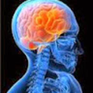 Meet your Posher, Dale